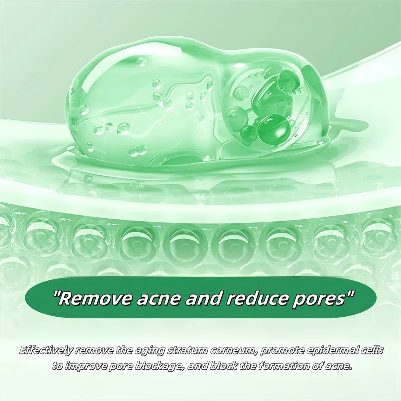 Pore Shrinking Cream Acne Pit Repair Product For Men Women Remove Acne Print Scar Large Pore Anti-Inflammatory Smooth Skin Cream