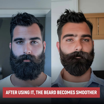 Beard essential oil rich in castor oil,Beard Growth And Grooming Soften Nourish Beard Care Roller needle length less than 0.25mm