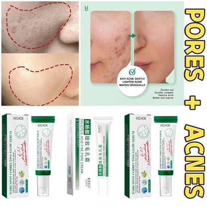 Pore Shrinking Cream Acne Pit Repair Product For Men Women Remove Acne Print Scar Large Pore Anti-Inflammatory Smooth Skin Cream