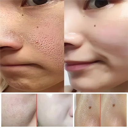 Pore Shrinking Cream Acne Pit Repair Product For Men Women Remove Acne Print Scar Large Pore Anti-Inflammatory Smooth Skin Cream